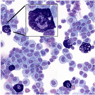 Rätselhafte Zellen des Immunsystems