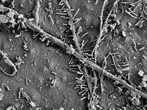 Rasterelektronenmikroskopische Aufnahme von Mikroorganismen, die das Polymer nach sechs Wochen im Boden besiedeln