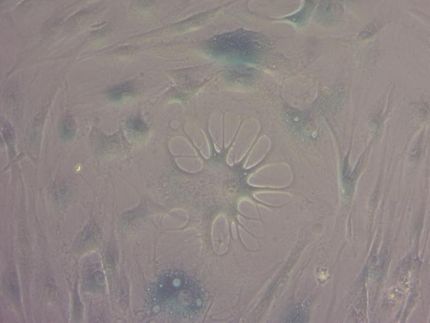 Key aspects of human cell aging reversed by new compounds