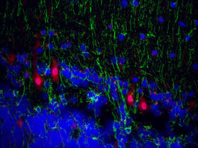 Überraschender Fund in Nervenzellen