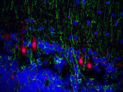 Überraschender Fund in Nervenzellen