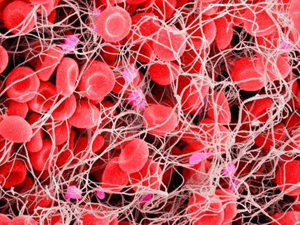 Identificada una molécula sencilla que inhibe el efecto del fármaco anticoagulante más común