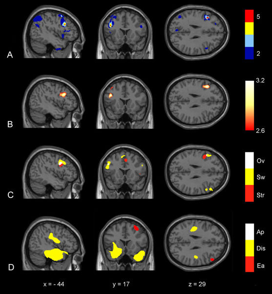 © MPI f. Kognitions- und Neurowissenschaften