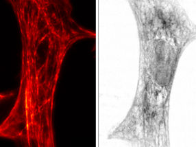 Neuartiges Mikroskopieverfahren macht „dunkle Seite“ der Zelle sichtbar