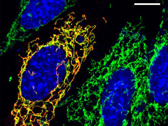 Mitochondrial Biology Unit, University of Cambridge