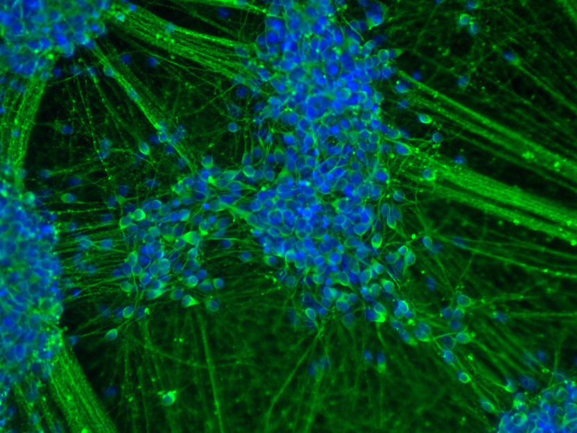 © Institut für Rekonstruktive Neurobiologie/Uni Bonn