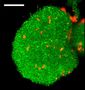 How fatal biofilms form
