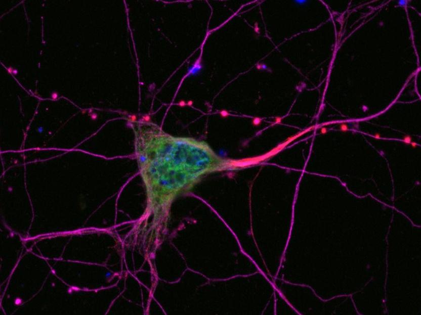 Universitätsklinik Ulm für Neurologie Ulm/RKU