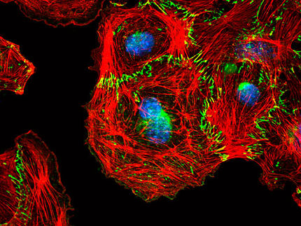 Essenzielles Protein für Gefäßneubildung identifiziert