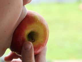 Berliner Forscher sind Apfel-Allergie auf der Spur