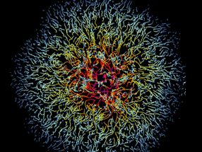 Poxvirus hijacks cell movement to spread infection