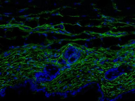 La piel envejece por la pérdida de identidad y función de las células principales de la dermis