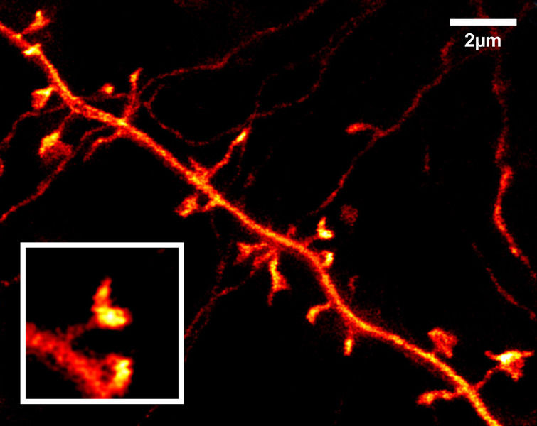 © Max-Planck-Institut für biophysikalische Chemie