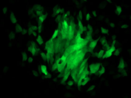 Unbekannter Hemmmechanismus für Humanes Cytomegalievirus entdeckt