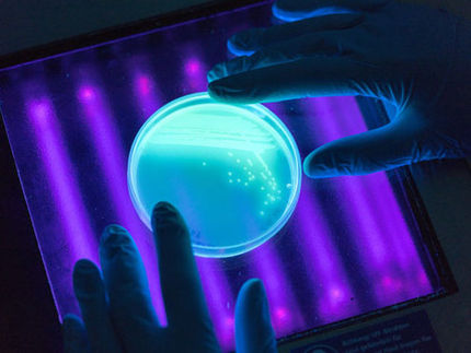 Nützliche Bakterien: Forschungsteam entdeckt Filterfunktion des Magens