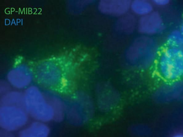 J.L. Garrido et al., Science Translational Medicine (2018)