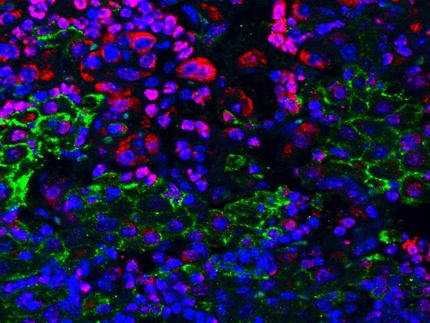 Den Tumor schachmatt setzen