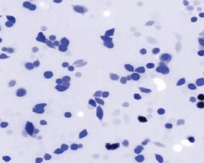 Micrograph of human cells