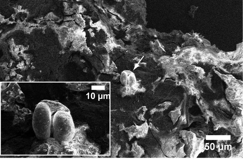 Neue Proteinanalyse-Methode offenbart prähistorisches Fischrezept - Entschlüsselung von 6000 Jahre alten Rezepten