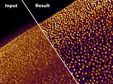 Selbstlernende Netzwerke lassen Forscher mehr sehen