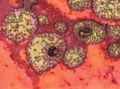 Erhöhter Hormonspiegel kennzeichnet Leberprobleme bei Mäusen mit Methylmalonsäureanämie