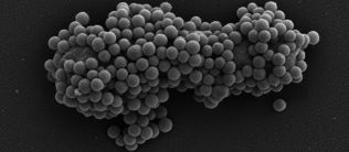 Mit Nanopartikeln gegen multiresistente Keime