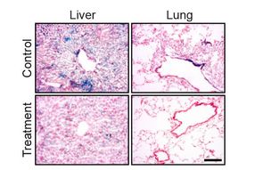 The immune system's fountain of youth