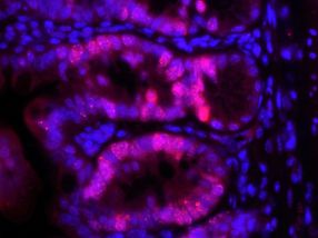 Fehlerhafte DNA-Reparatur in Darm-Stammzellen führt zu Krebs