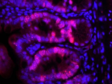 Fehlerhafte DNA-Reparatur in Darm-Stammzellen führt zu Krebs
