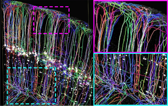 Dem Zusammenspiel der Nervenzellen zusehen - Neue Bioimaging-Technik ermöglicht bislang unerreichte Einblicke