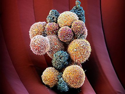 Medikament gegen Metastasenbildung identifiziert