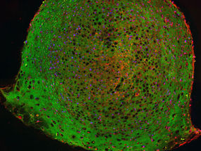 Stammzellen regulieren ihr Schicksal, indem sie ihre Steifigkeit verändern