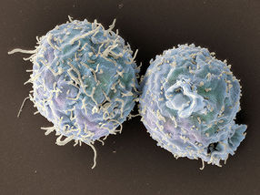 Modifizierte T-Zellen verhindern Abstossungsreaktion bei Organtransplantation