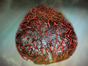 Deciphering diabetes with "game-changing" human blood vessels from stem cells