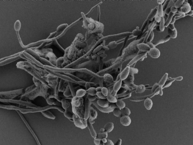 The image was acquired at the Umeå Core Facility for Electron Microscopy (UCEM)