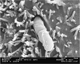 Gefährliches Bakterium bekommt kalte Füße