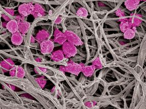 Thrombozyten-"Köder" überlisten sowohl Gerinnsel als auch Krebs