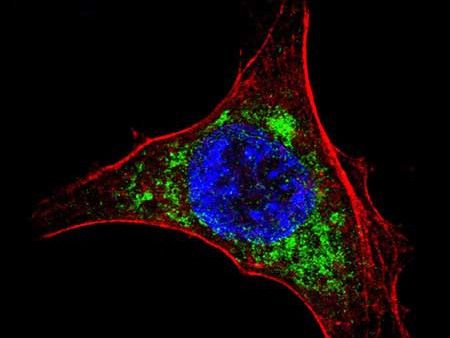 Científicos del CSIC desarrollan nuevas vacunas contra la hepatitis C - Las nuevas vacunas DREP-HCV, combinadas con una vacuna desarrollada anteriormente, consiguen una mayor respuesta inmune frente al virus