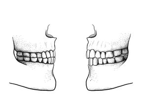 Bis zum Ende der Steinzeit entwickelten erwachsene Menschen in der Regel einen Kopfbiss (links), bei dem die Schneidezähne genau aufeinander stoßen. Danach setzte sich als Folge weicherer Nahrung mehr und mehr ein Überbiss (rechts) durch, das heißt die oberen Schneidezähne ragen leicht über die unteren hinaus. Diese Zahnstellung ermöglicht erst die Bildung bestimmter Sprachlaute, etwa des "f".
