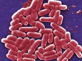 Bakterien spielen auf Zeit, wenn Antibiotika angreifen