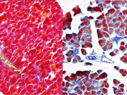 Revelan un nuevo mecanismo molecular implicado en la reparación pancreática