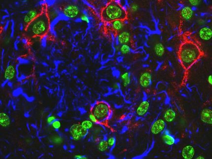 Wissenschaftler erprobt neuen Ansatz in Alzheimer-Forschung