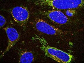 Spying on cells eating habits could aid cancer diagnosis