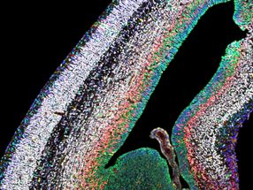 Wie Stammzellen ein Gehirn korrekter Größe und Zusammensetzung bauen