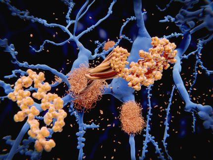 Identifying the molecular structure of one of Alzheimer's stickier culprits