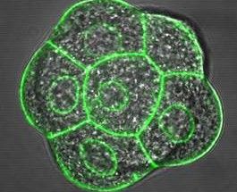 Raumgestaltung für das Erbgut