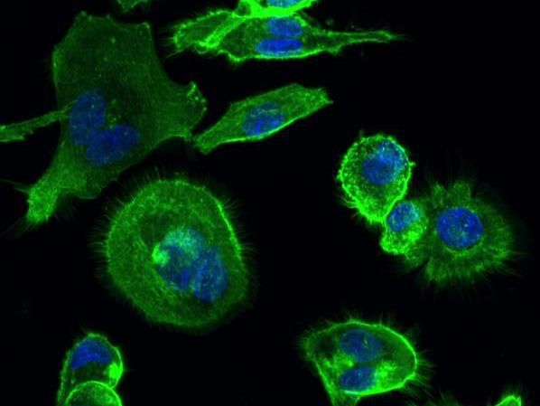 Bakterien in fermentierten Lebensmitteln interagieren mit unserem Immunsystem