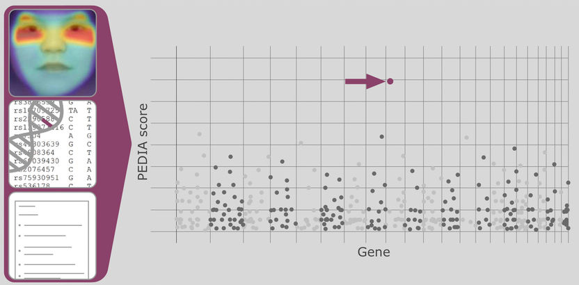 How Artificial Intelligence Detects Rare Diseases