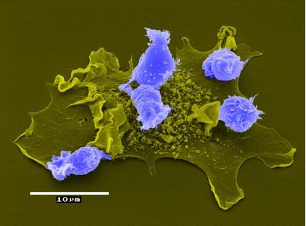 Warum Immun-Stammzellen im Alter schwinden