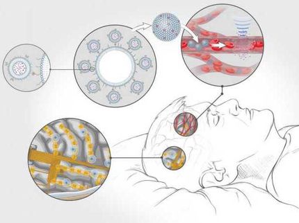 Brain stimulation against stress disorders?